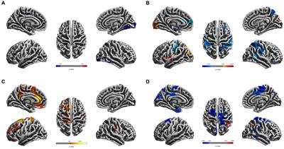 Structural brain morphometry differences and similarities between young patients with Crohn’s disease in remission and healthy young and old controls